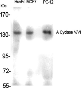 A Cyclase V/VI antibody