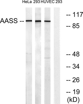 AASS rabbit pAb Antibody