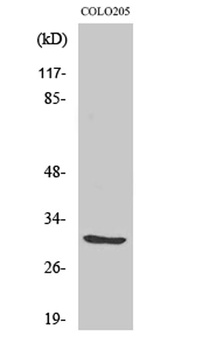ABHD11 rabbit pAb Antibody