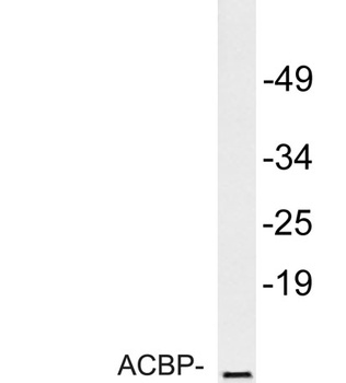 ACBP rabbit pAb