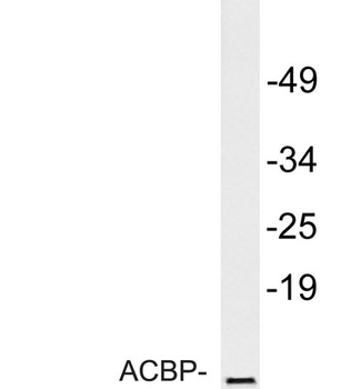 ACBP antibody