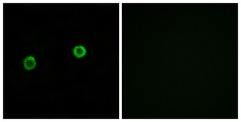 ACOT4 rabbit pAb Antibody