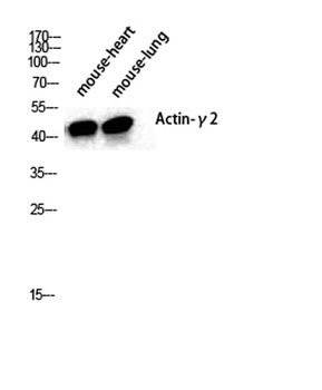 Actin alpha3 antibody