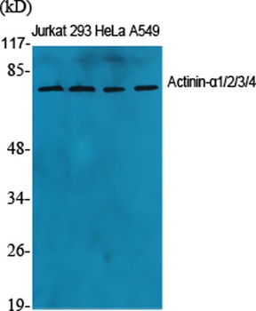 Actinin-alpha1/2/3/4 antibody
