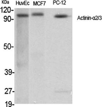 Actinin-alpha2/3 antibody