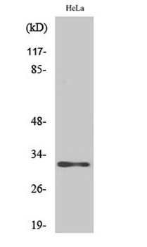 AIG-1 antibody