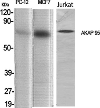 AKAP 95 antibody