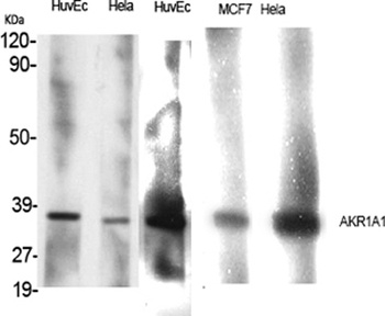 AKR1A1 antibody