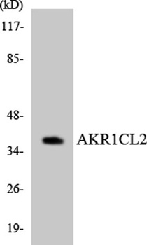 AKR1CL2 rabbit pAb