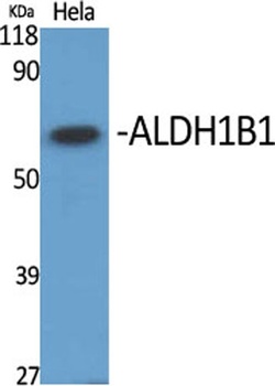 ALDH1B1 antibody