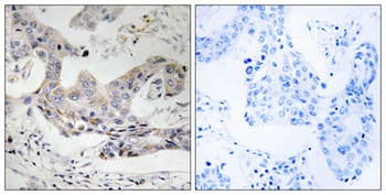 ALDH3B1 rabbit pAb Antibody