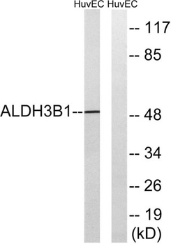 ALDH3B1 rabbit pAb Antibody