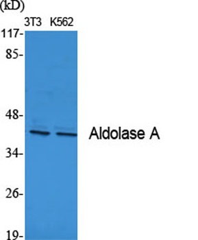 Aldolase A antibody