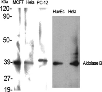Aldolase B rabbit pAb