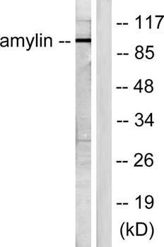 Amylin antibody