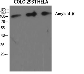 Amyloid-beta antibody