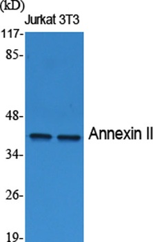 Annexin II antibody