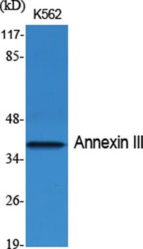 Annexin A3 antibody