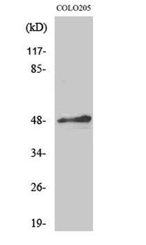 AP-2alpha/beta antibody