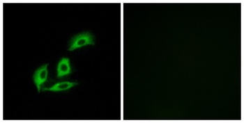 APBA2BP rabbit pAb Antibody