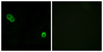APHC rabbit pAb Antibody