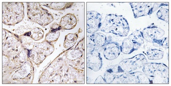 APHC rabbit pAb Antibody