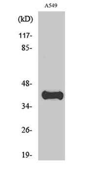 ApoL1 antibody