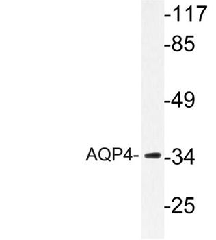 AQP4 rabbit pAb Antibody