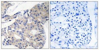 ARA70 rabbit pAb Antibody