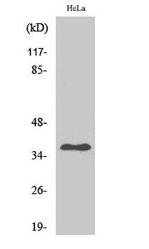 Arginase II antibody