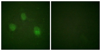 ARK-2 rabbit pAb Antibody