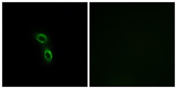 ARMC6 rabbit pAb Antibody