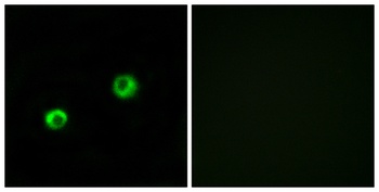 Arylsulfatase I rabbit pAb Antibody