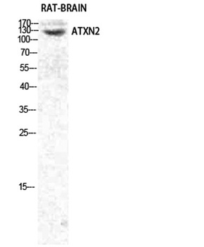 Ataxin-2 antibody