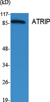 ATRIP antibody