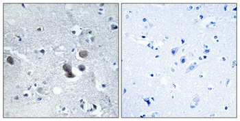 BIG2 rabbit pAb Antibody