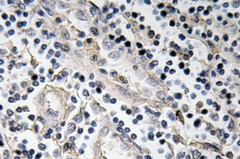 BMP-7 antibody