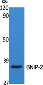BNIP-2 rabbit pAb
