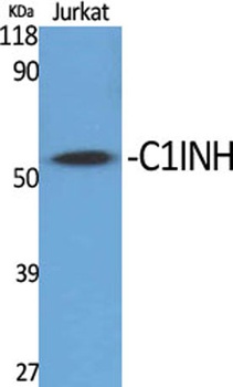 C1INH antibody