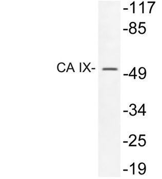 CA IX rabbit pAb Antibody