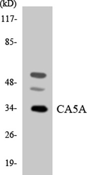CA VA rabbit pAb Antibody