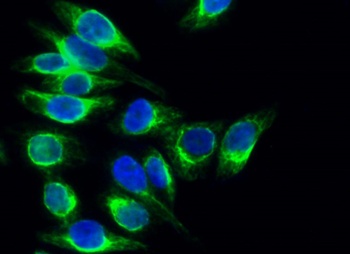 Calregulin antibody