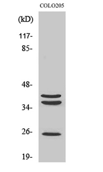 Cathepsin B antibody