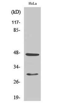 Cathepsin D rabbit pAb