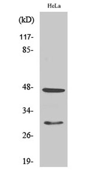 Cathepsin D antibody