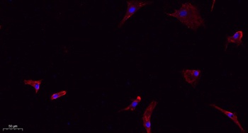 Caveolin 1 antibody