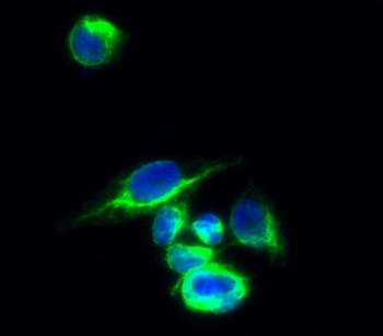 Galectin 3 antibody