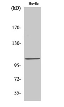 CCP2 antibody