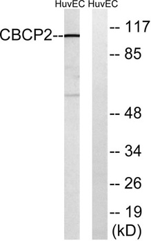 CCP2 rabbit pAb Antibody