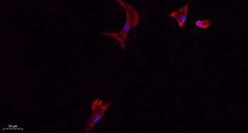 CD284 antibody